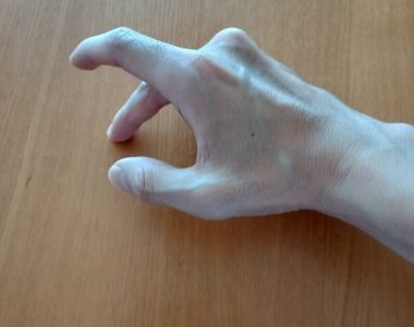 image2 直接打診法